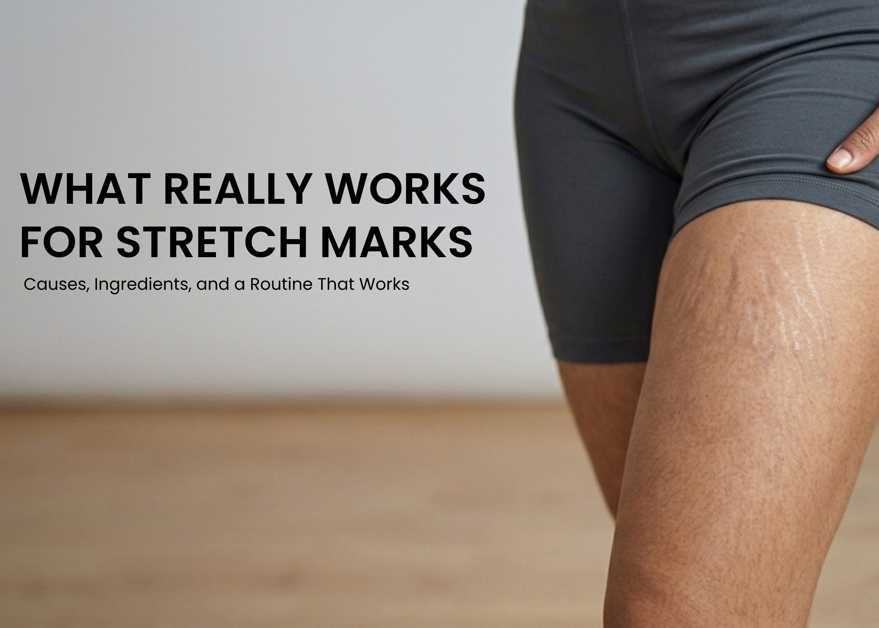 does glutathione clear stretch marks How to Reduce Marks: Ingredients That Help – mCaffeine Easy Touch Size:GHK-Cu 100mg Now Available in UAE.,