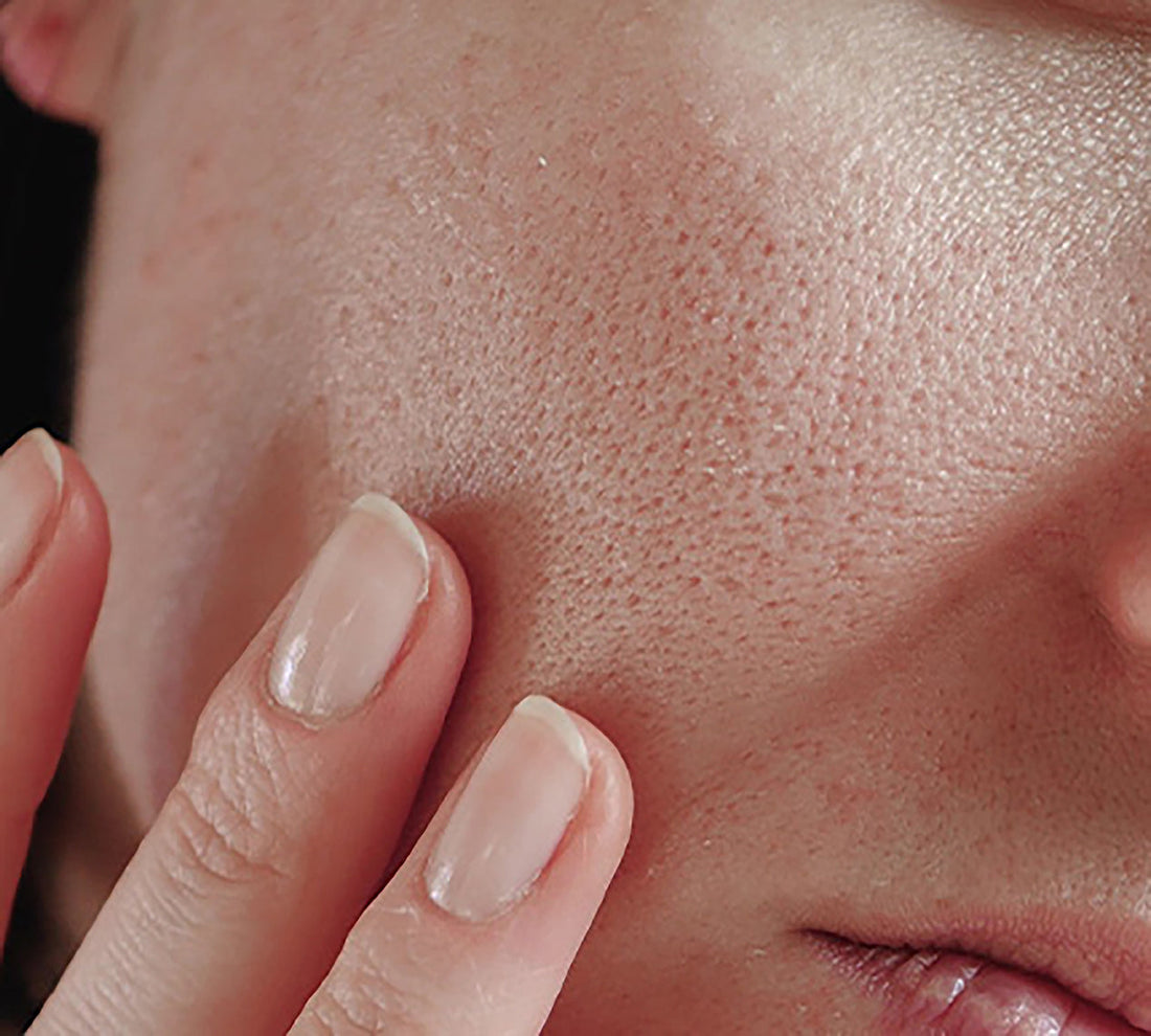 Treat Enlarged Pores the Caffeinated Way