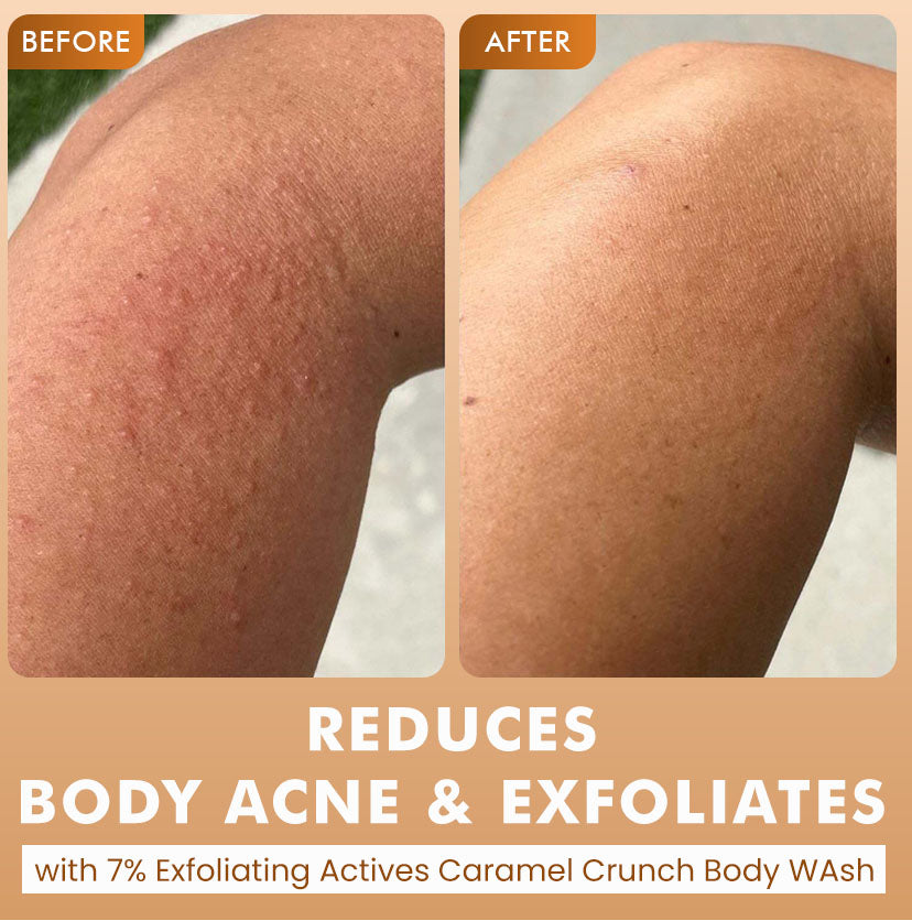 De-Tan & Exfoliating Body Washes (Set of 2)