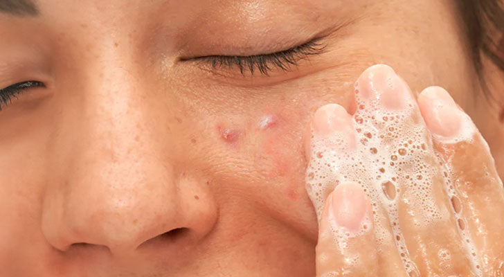 Why should you buy it? - 2