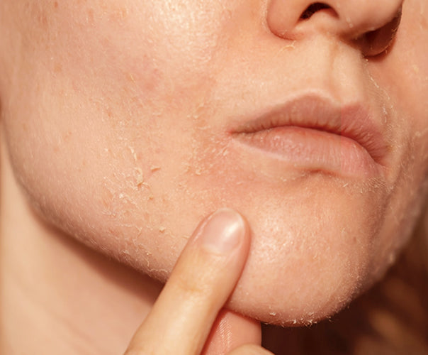 Shop By Concerns - Dry Skin