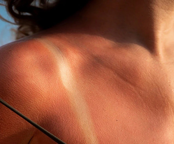 Shop By Concerns - Tan Removal