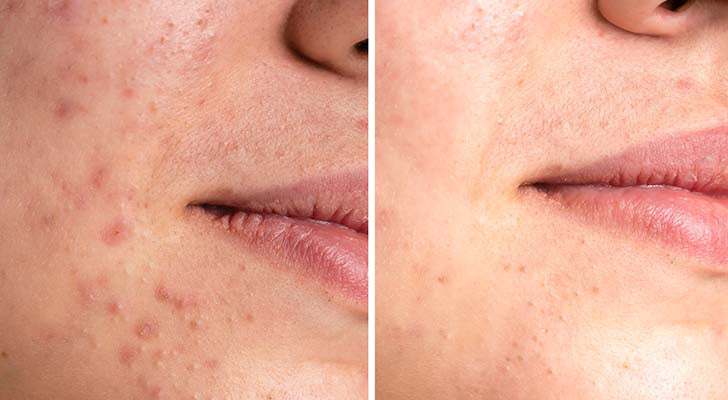 Why should you buy it? - 1