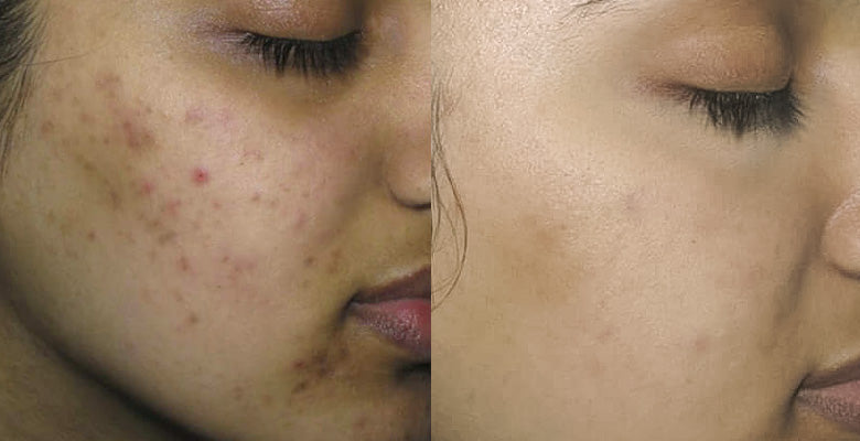 Why should you buy it? - 1