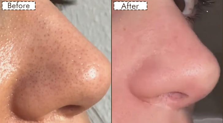 Why should you buy it? - 1