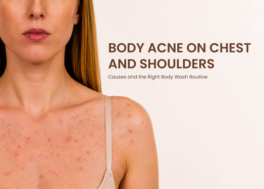 Body Acne on Chest and Shoulders
