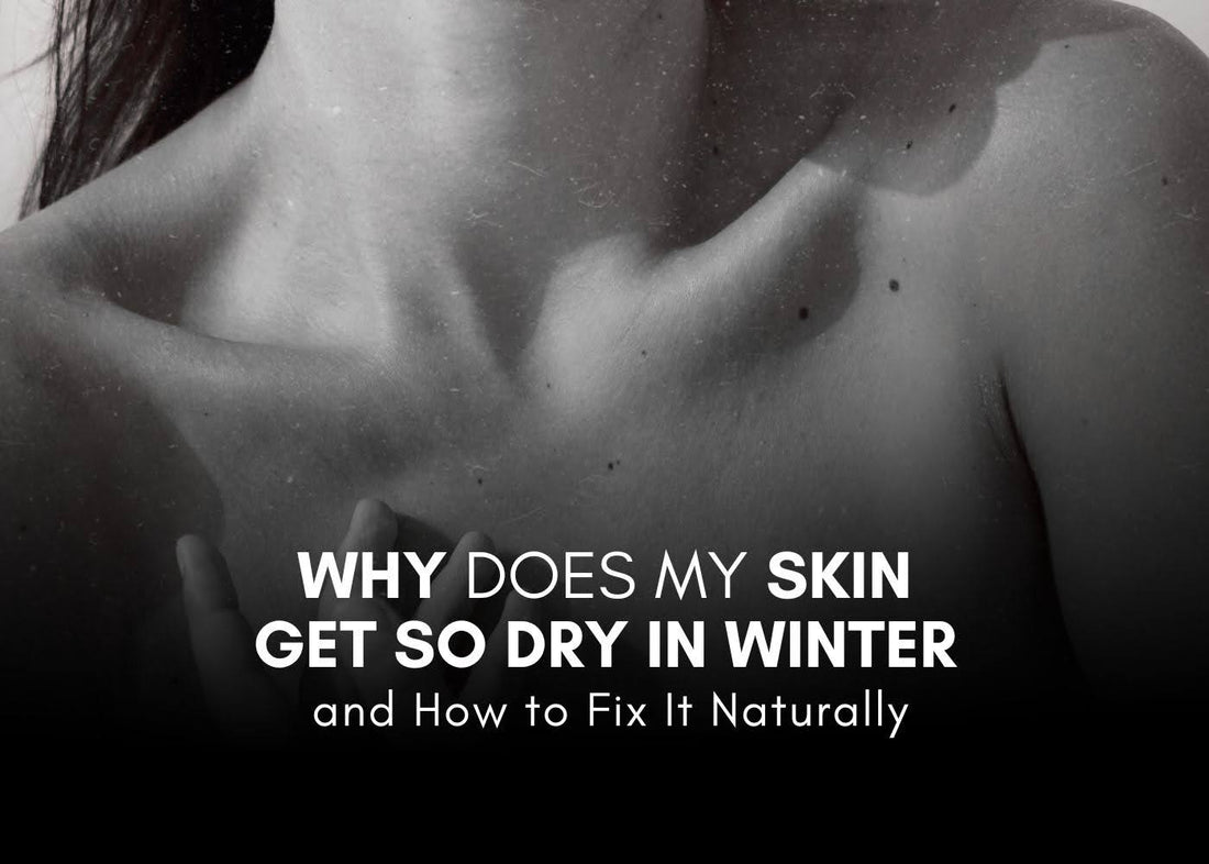 Why Does My Skin Get So Dry in Winter, and How to Fix It Naturally