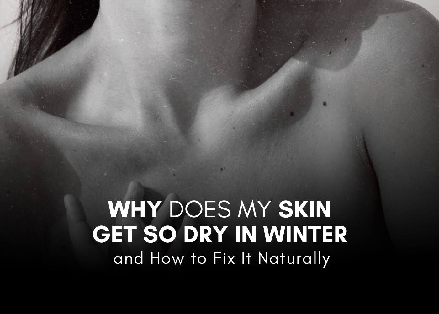 Why Does My Skin Get So Dry in Winter, and How to Fix It Naturally
