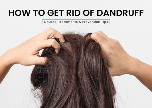 How to Get Rid of Dandruff