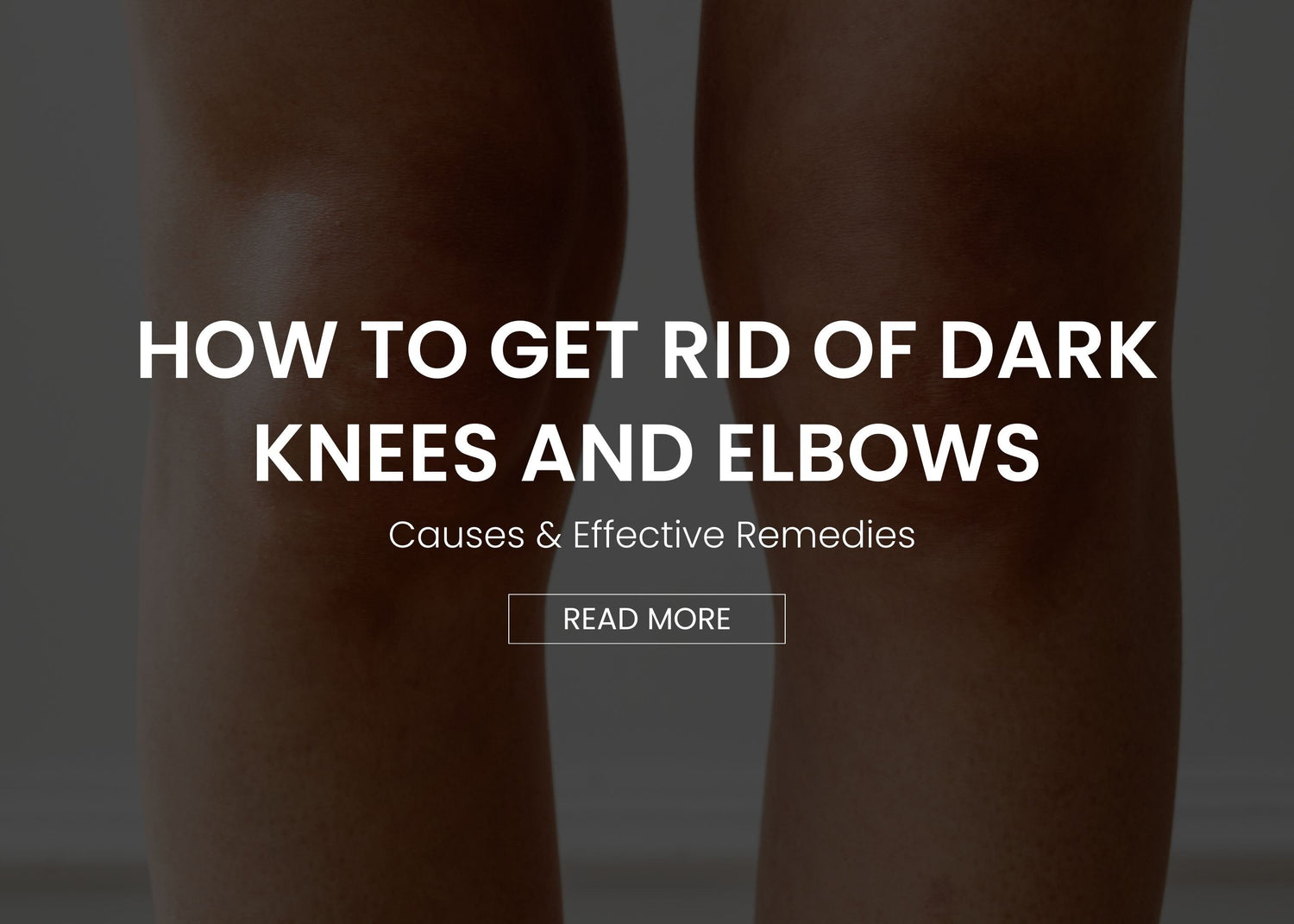 How to Get Rid of Dark Knees and Elbows: Causes & Effective Remedies