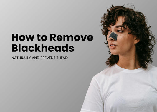 How to Remove Blackheads Naturally and Prevent Them