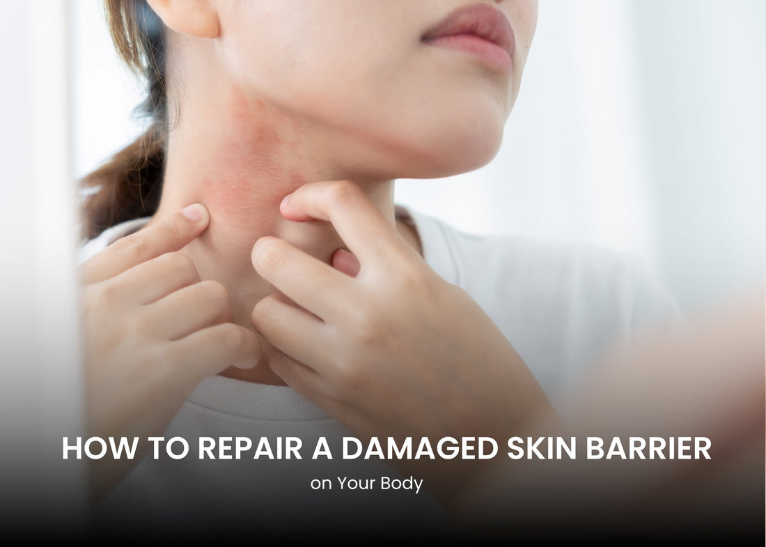 How to Repair a Damaged Skin Barrier on Your Body