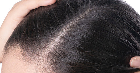 Effective Tips To Get Rid Of Dandruff In Monsoon