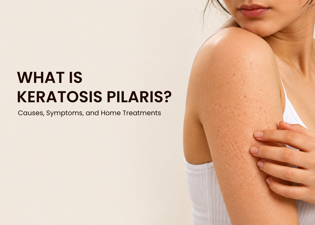 What Is Keratosis Pilaris? Causes, Symptoms, and Home Treatments