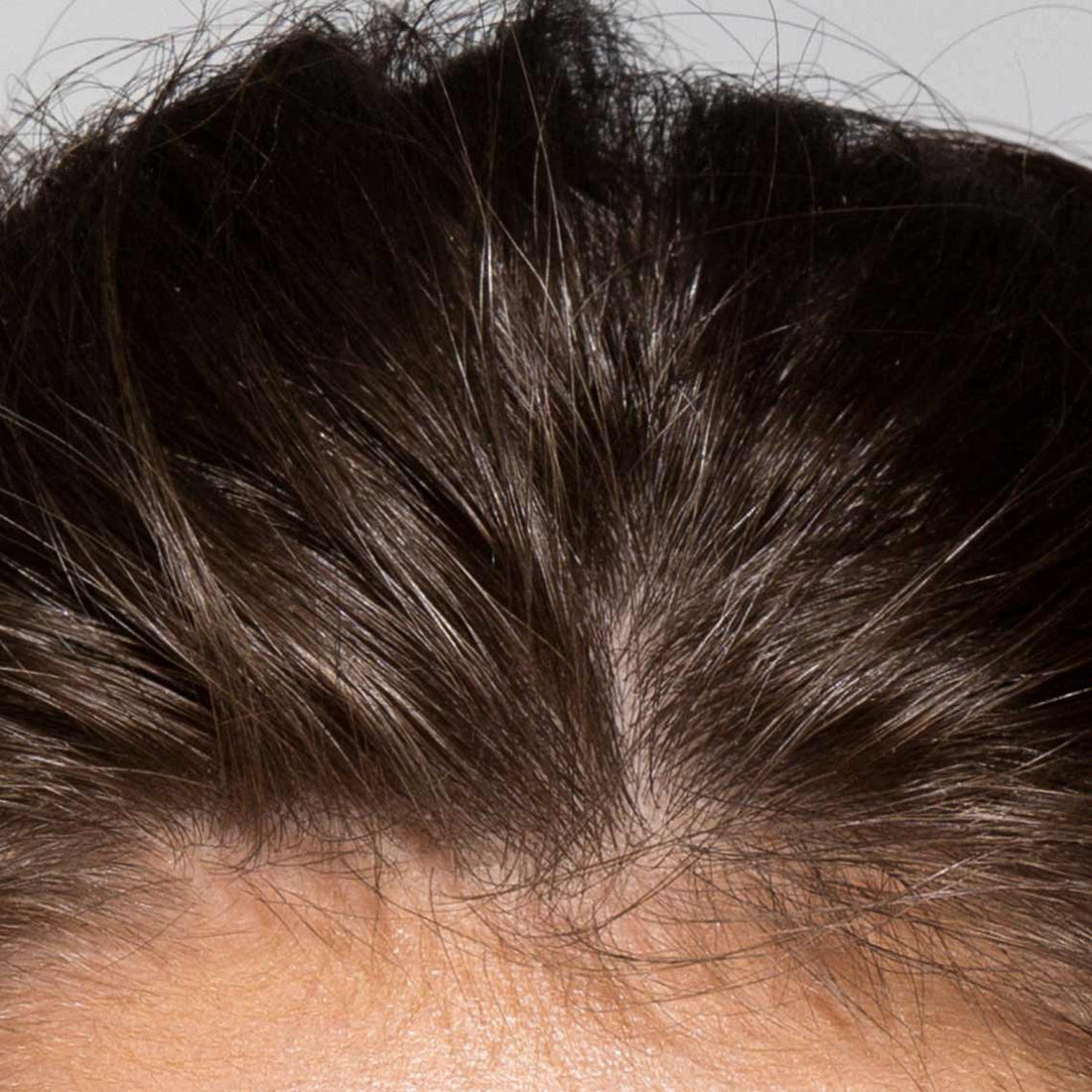 How to avoid hair fall in monsoon