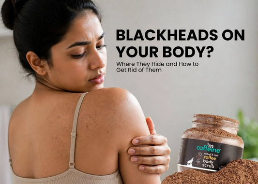 Blackheads on Your Body