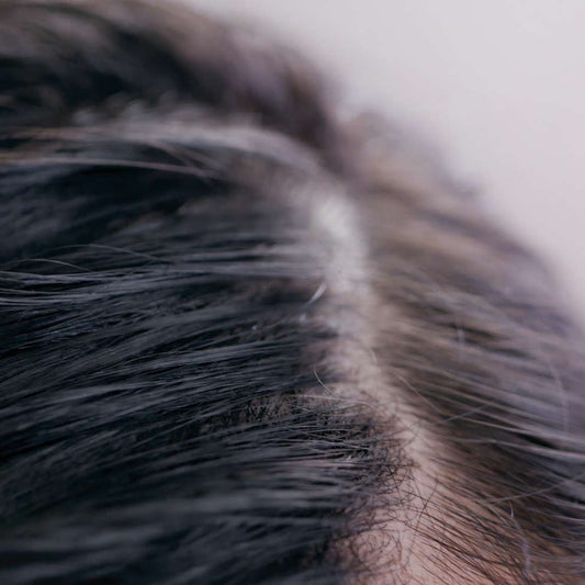 How much you take care of your scalp?