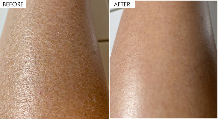 Why should you buy it? - 3