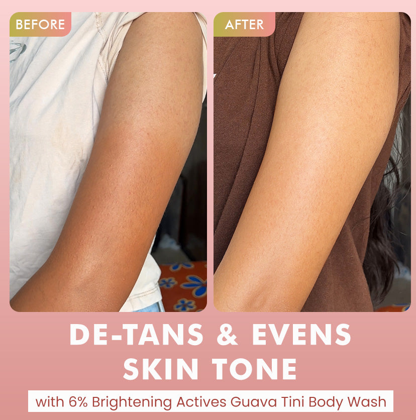 Brighten, De-Tan & Acne-Free Body Wash Combo