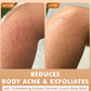 Brighten, De-Tan & Acne-Free Body Wash Combo