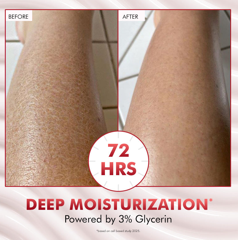 mCaffeine 11% AHA BHA Strawberry Body Lotion 200 ml - before and after leg comparison with the 72-hour moisturisation callout