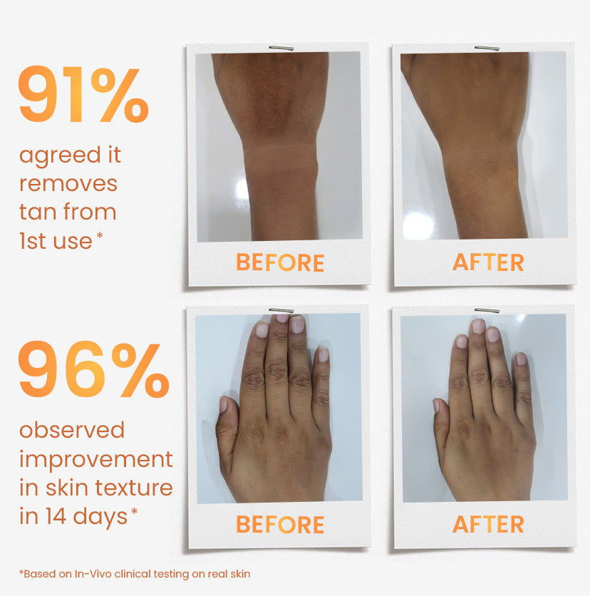 mCaffeine Caramel Eclairs Coffee Body Scrub 175 g - before and after arm and hand comparisons with in-vivo study figures