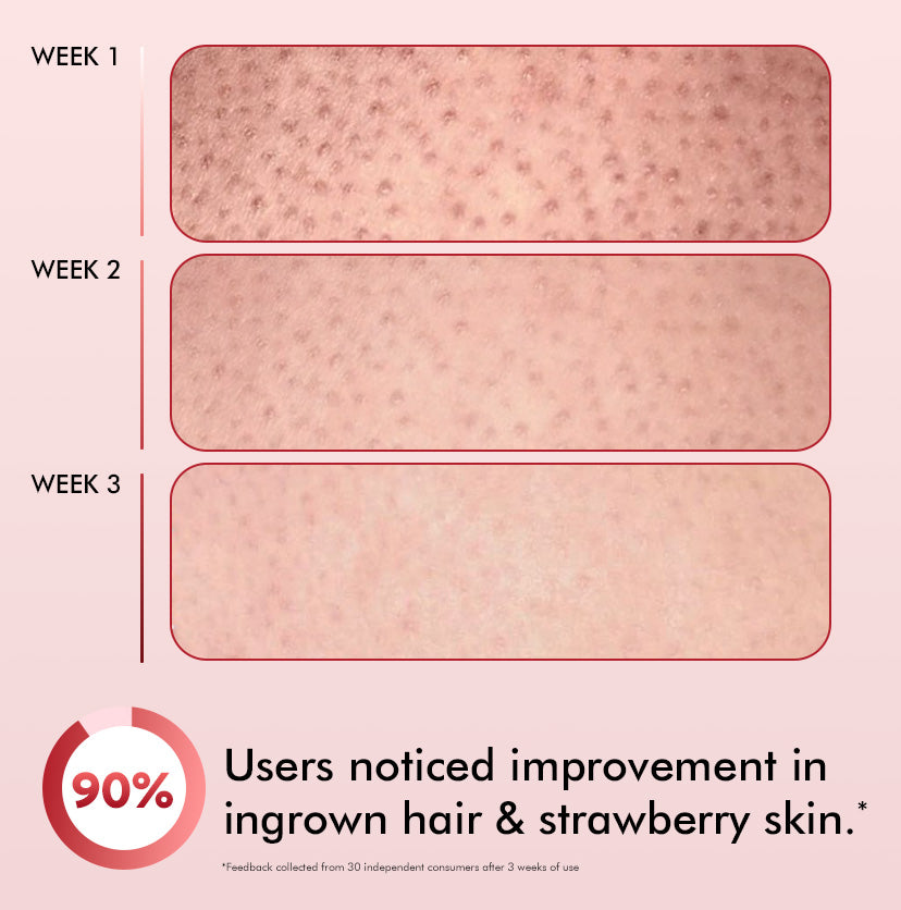 mCaffeine 11% AHA BHA Strawberry Body Lotion 200 ml - three-week skin progression panel with a consumer study footnote