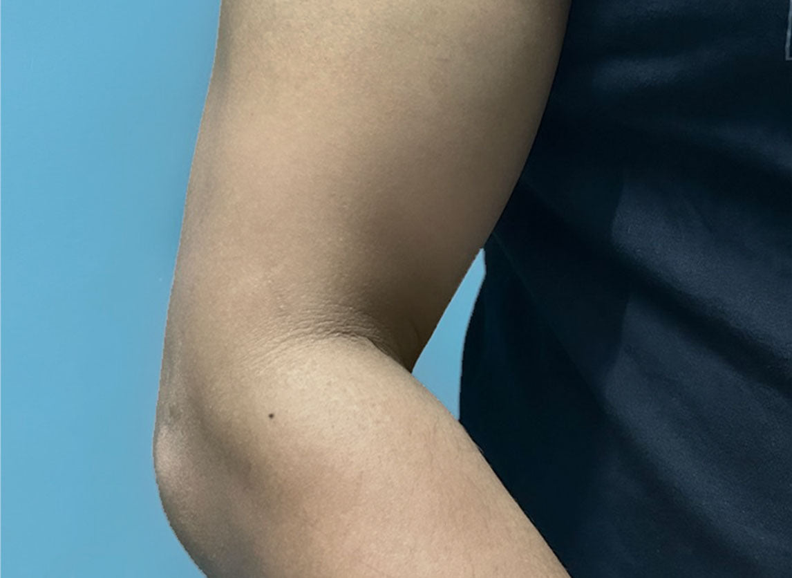 Prouduct comparison - After use