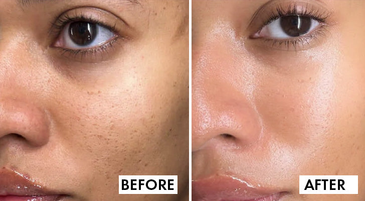 Why should you buy it? - 2