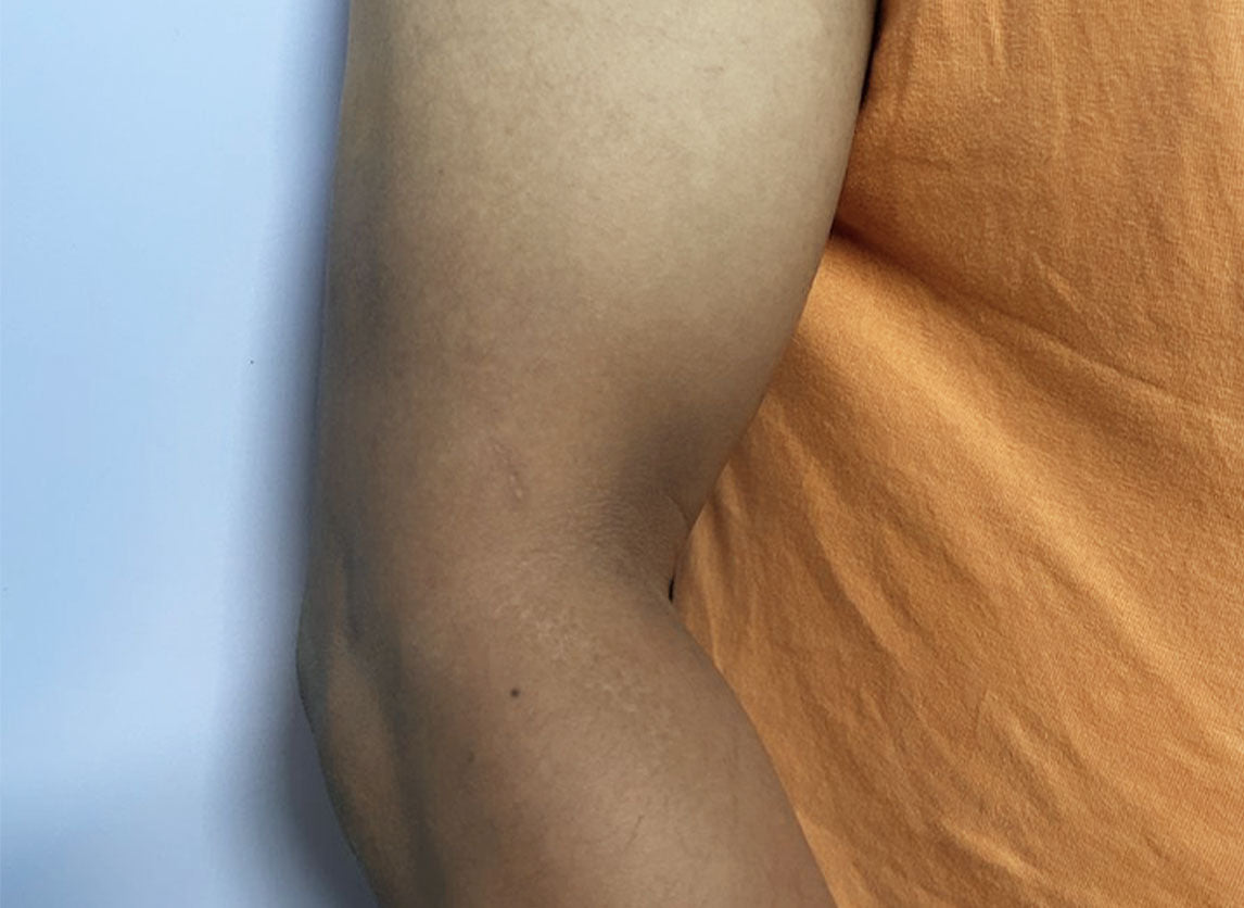 Prouduct comparison - Before use