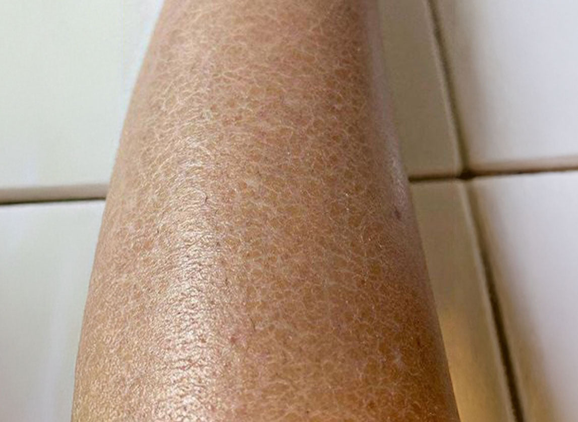 Prouduct comparison - Before use