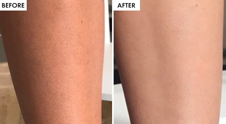 Why should you buy it? - 1