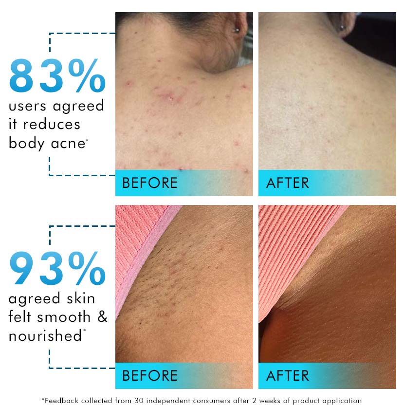 2% Salicylic Acid, 3-in-1 Perfume & Odour Control Body Wash