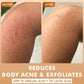 mCaffeine Caramel Crunch Exfoliating Body Wash 300 ml - before and after knee comparison with the salicylic and lactic acid callout