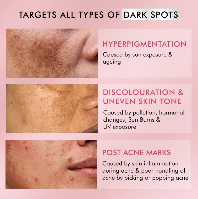 Brightening Serum Pads - 3% Niacinamide & Kojic Acid - 40 PCs (x1)
