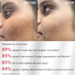 Brightening Serum Pads - 3% Niacinamide & Kojic Acid - 40 PCs (x1)