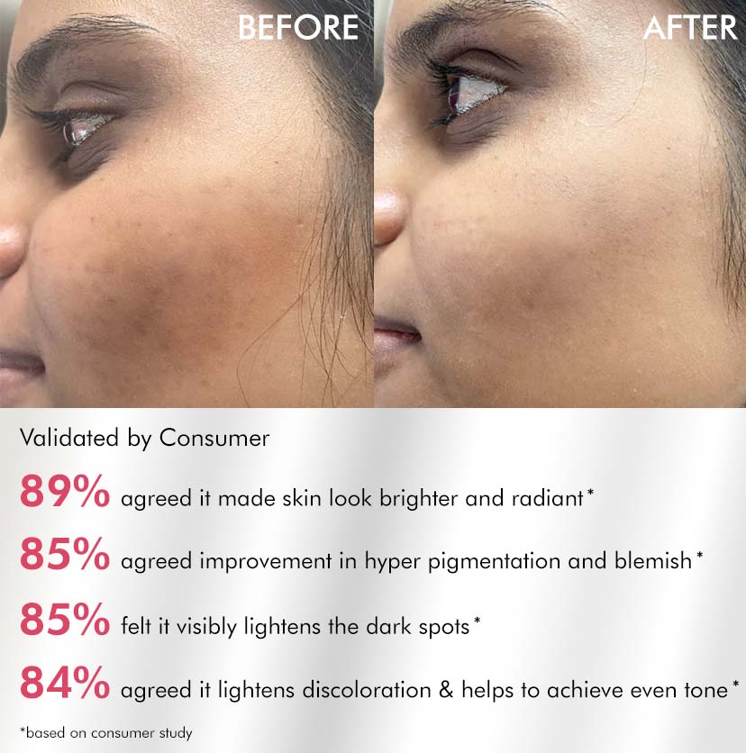 Brightening Serum Pads - 3% Niacinamide & Kojic Acid - 40 PCs (x1)