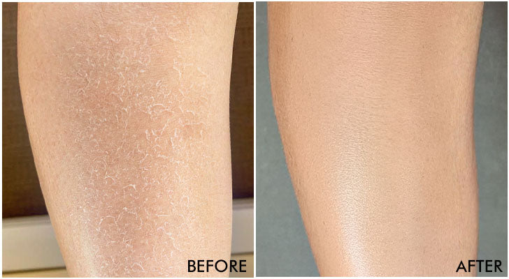 Why should you buy it? - 1