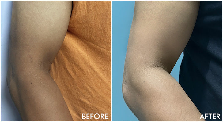 Why should you buy it? - 2