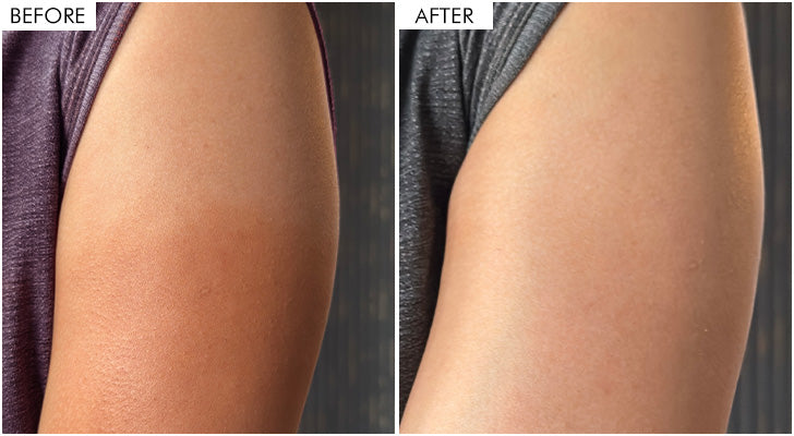 Why should you buy it? - 1