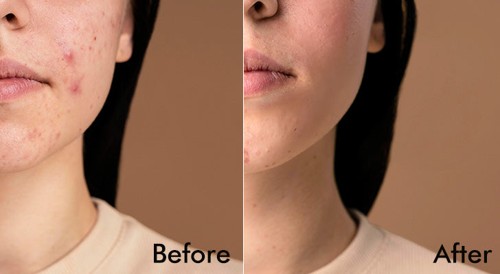 Why should you buy it? - 1