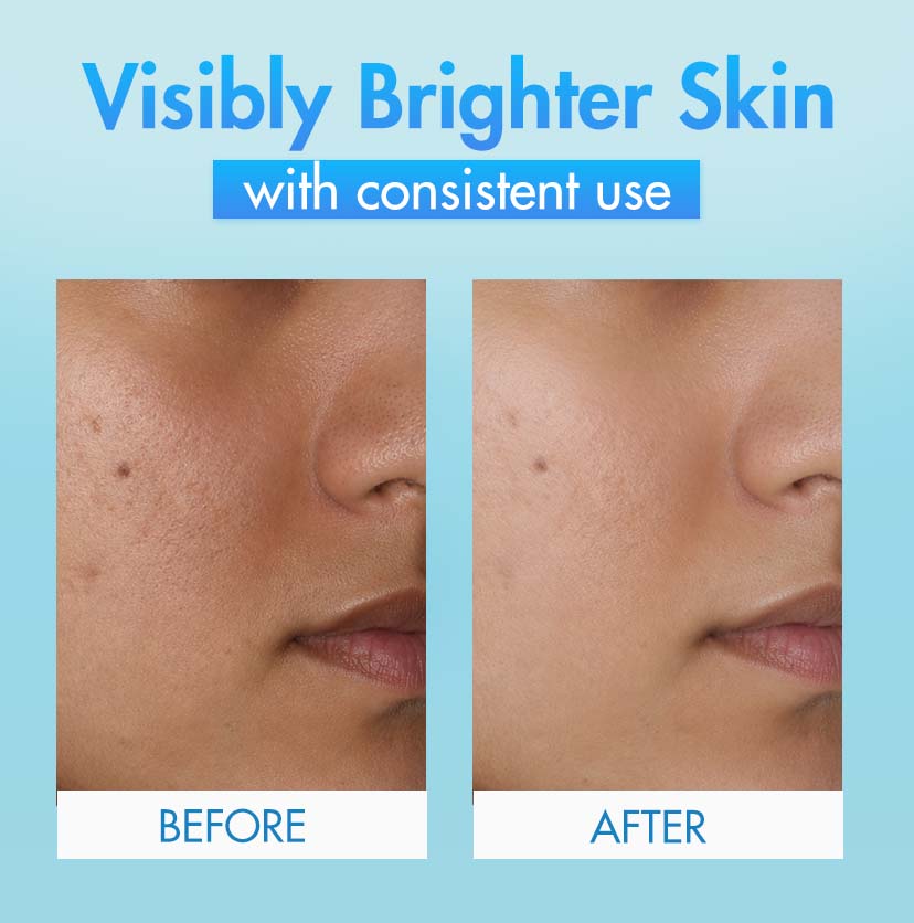 Brightening Face Scrub - 100gm
