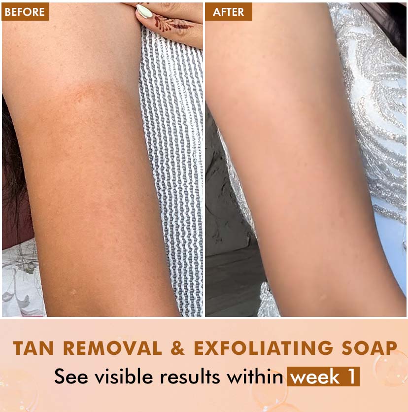 Exfoliating Tan Removal 1% Salicylic Acid & Lactic Acid Caramel Crunch Soap - 300g (3x100g)