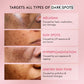 Brightening & Anti-Dullness Serum - 3% Tranxemic & 2% Alpha Arbutin