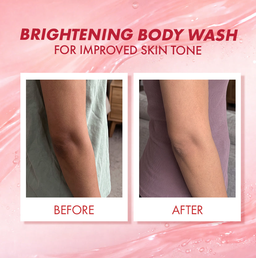 glutathione before and after for skin whitening 3 months Oral Glutathione Results ( Before & After ) : r/IndianSkincareAddicts Understanding Glutathione Injection Before and
