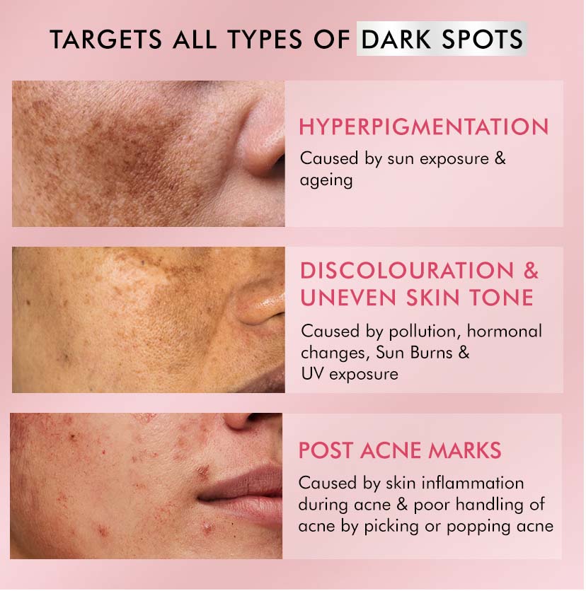 3 Step Skin Brightening Combo