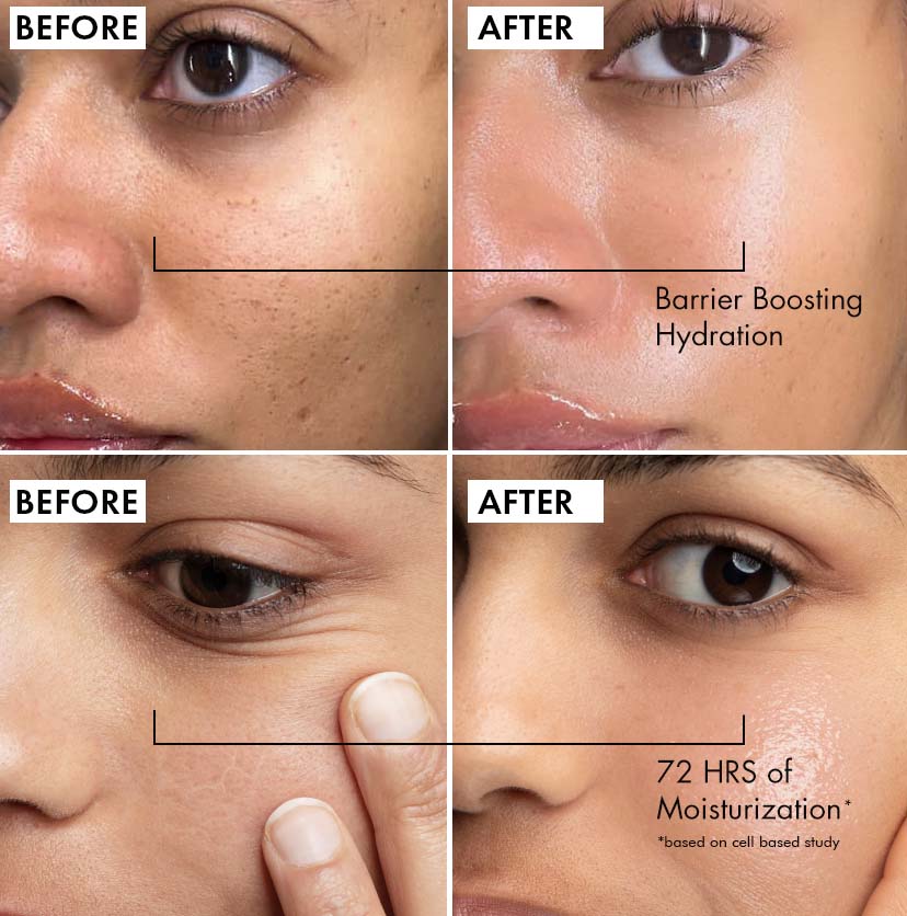 Hydra Repair Ceramide & Kombucha Tea Moisturizer
