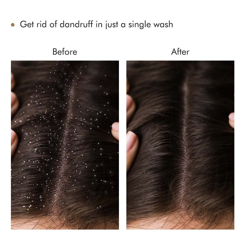 Coffee Scalp Scrub - 250 g